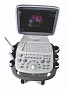 Ультразвуковой сканер S11, SonoScape